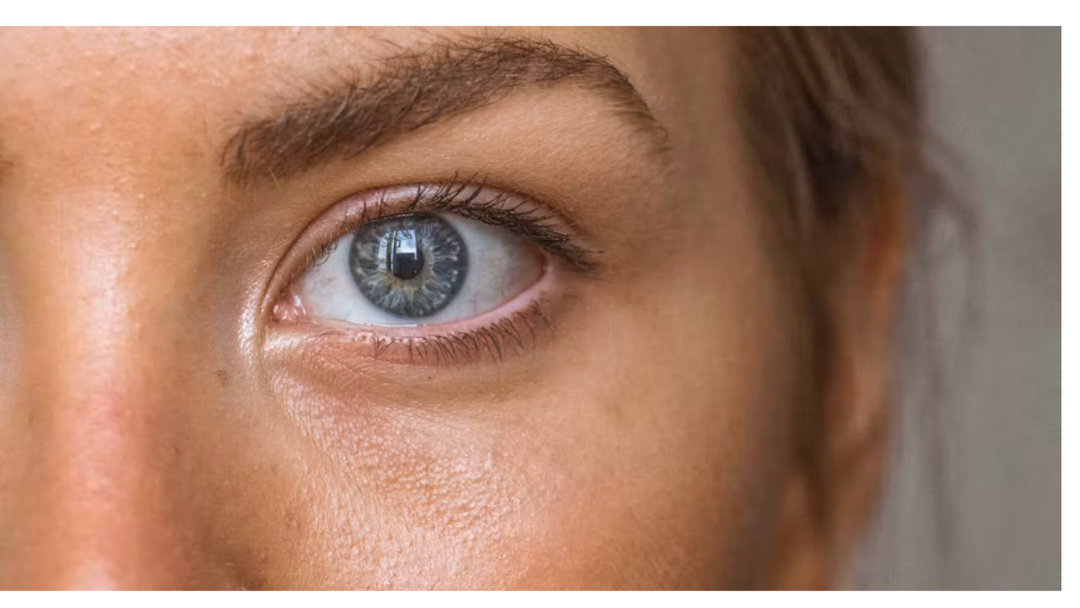When Meeting a Friend, Wash Your Eyes